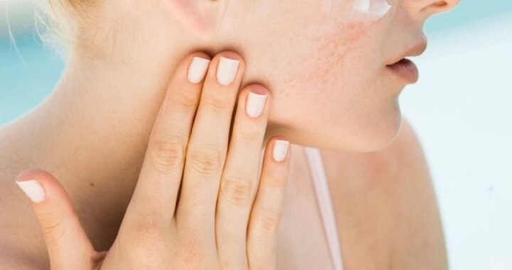 Ácido Hialurónico, Niacinamida o Retinol: ¿Cuál Necesita Tu Piel?